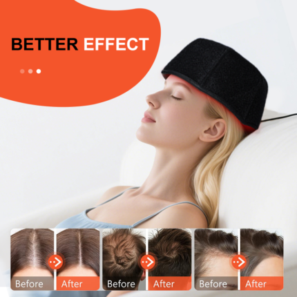 Dome Red Light Hair Growth Cap – main image 2